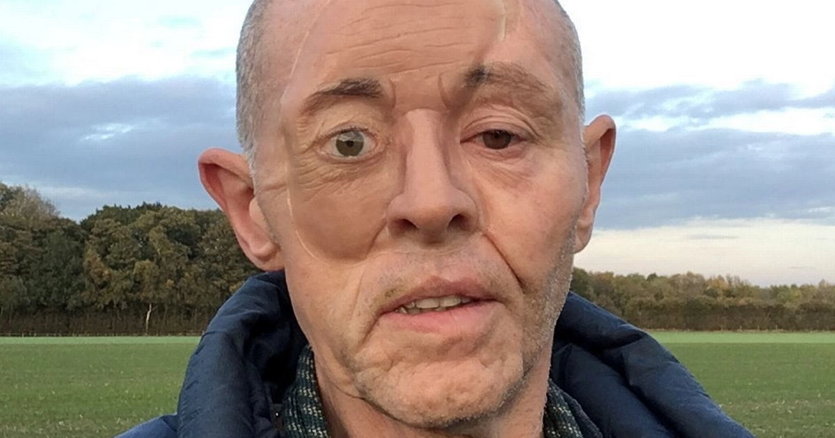 How 3D Printing Gave a Cancer Survivor a New Lease on Life