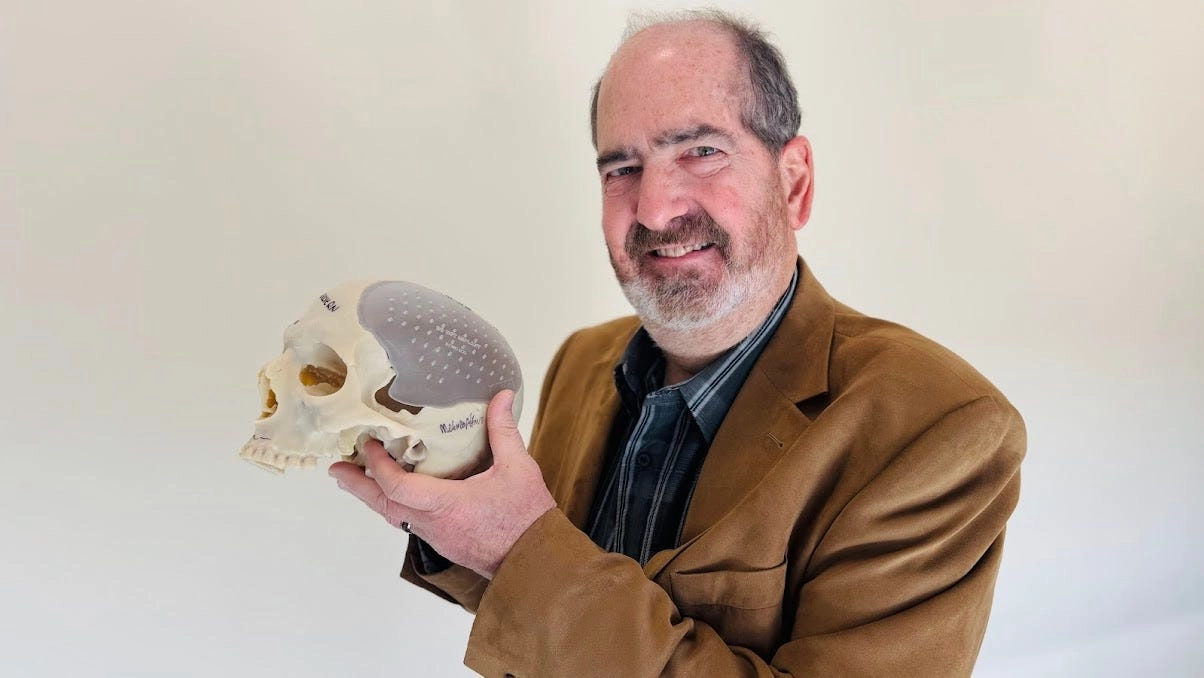 Revolutionary 3D Printing: Jersey Shore Doctors Replace Crumbling Skull Part in Brick Man’s Surgery