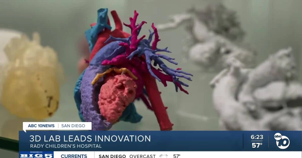 Revolutionizing Surgical Planning: Inside the 3D Printing Lab at Rady Children’s Hospital